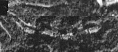 1934 Aerial Photograph Barker Road houses